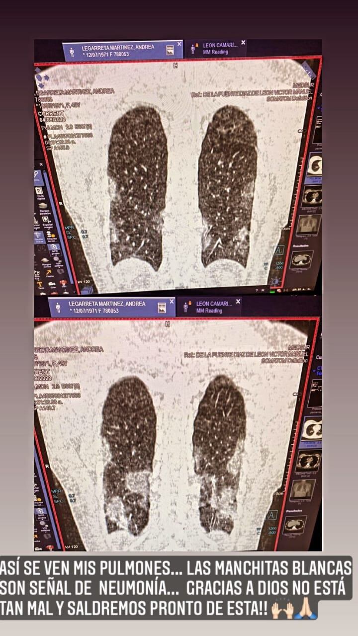 Radiografía de Andrea Legarreta