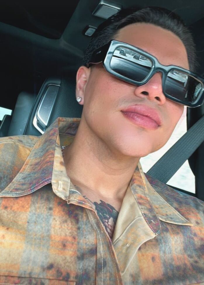 Eduin Caz con labios abultados