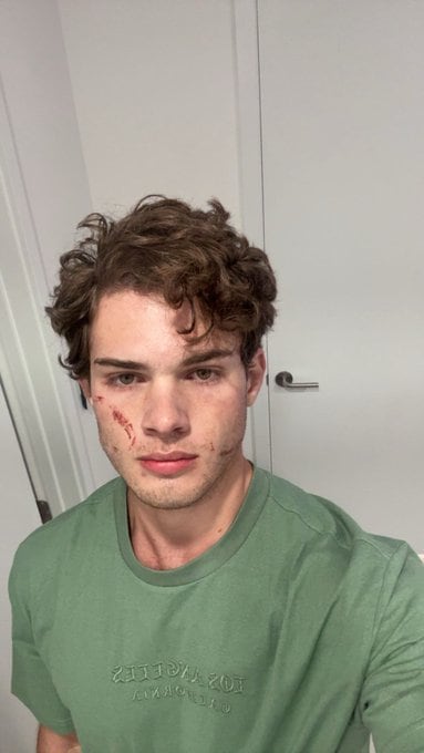 Lo que se sabe de la hospitalización de Clavicular por una posible sobredosis