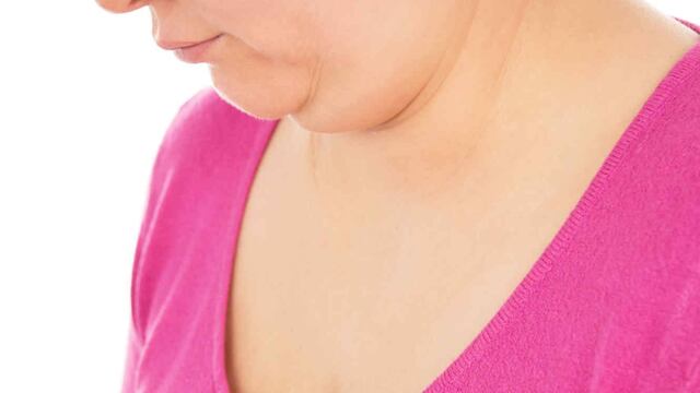 Bajar la papada es cuestión de cambiar de hábitos.