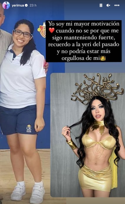 Yeri Mua antes de operarse