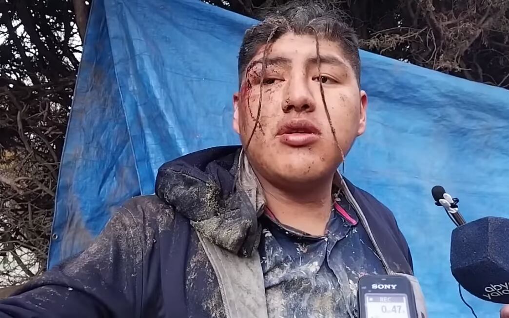 Víctor Hugo, quien despertó en el ataúd