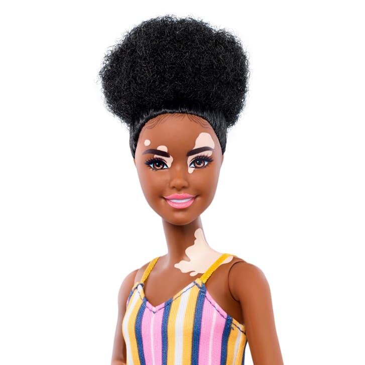Barbie con vitiligo.