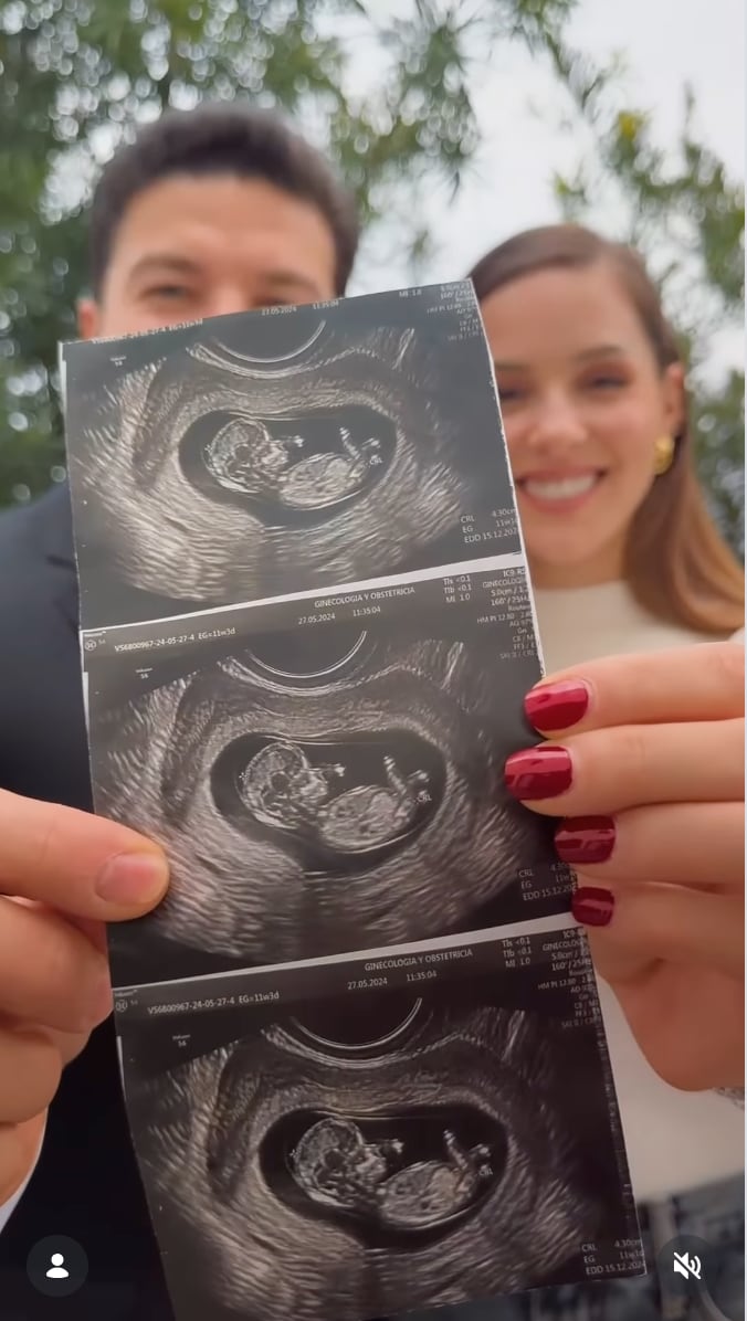 Mariana Rodríguez creó la imagen de ecografía de su embarazo con ChatGPT