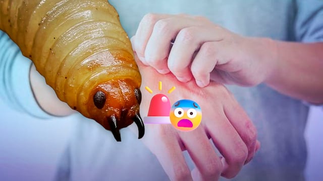 Alerta en Guerrero por un posible caso de gusano barrenador en humanos