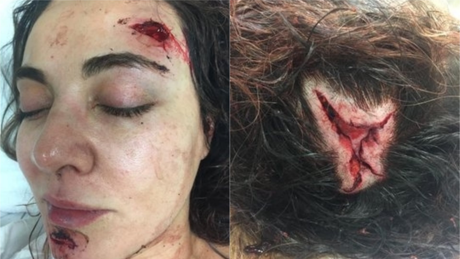Intento de feminicidio contra Abril Pérez en enero de 2019