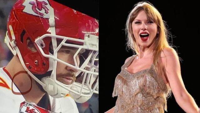 Travis Kelce tendría un chupetón hecho por Taylor Swift