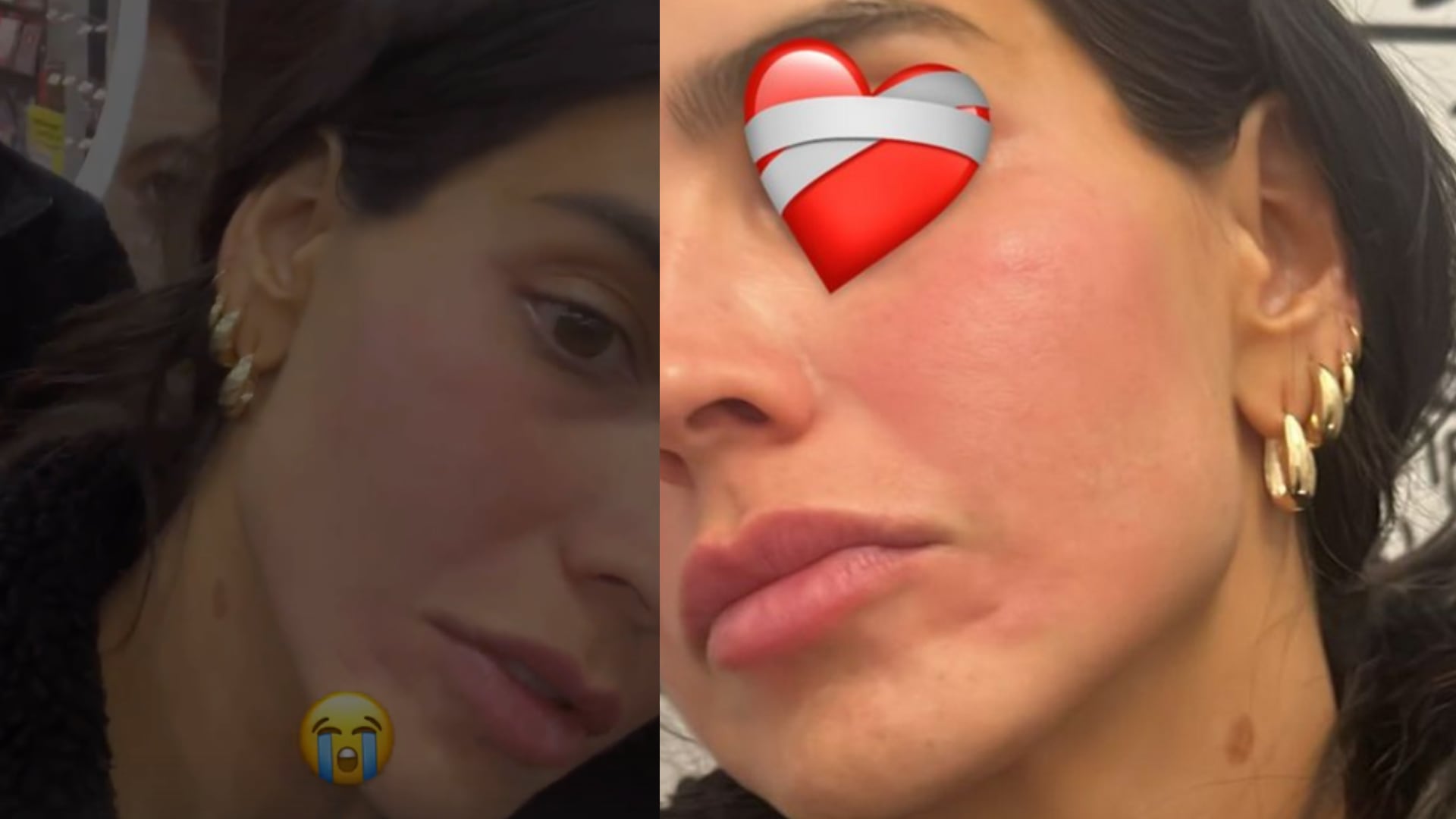 Bárbara de Regil comparte que se quemó la cara, pero en Nueva York.