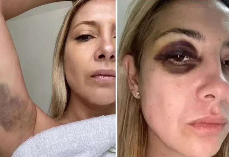 Fotos que muestran agresión de Alberto Fernández contra Fabiola Yañez