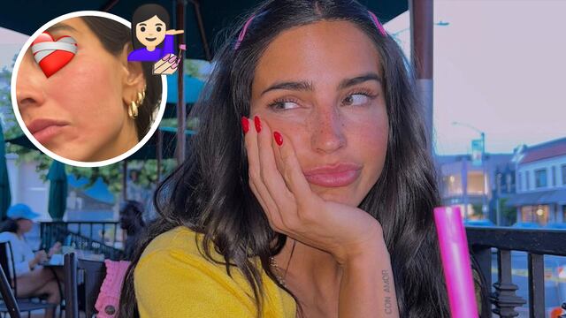 Bárbara de Regil comparte que se quemó la cara, pero en Nueva York.