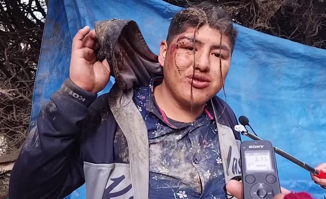 Víctor Hugo, quien despertó en el ataúd