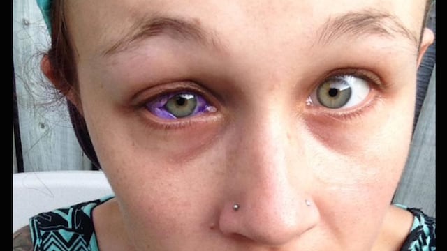 Tatuaje ocular.
