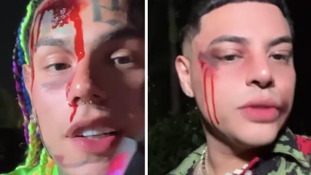 6ix9ine y Eduin Caz golpeados