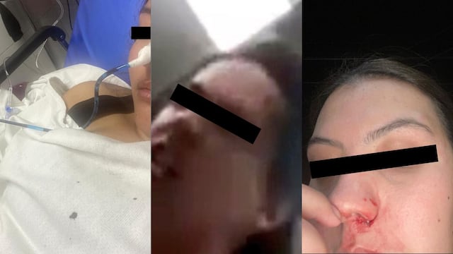 Estudiante de la UPAEP Puebla golpea a su exnovia