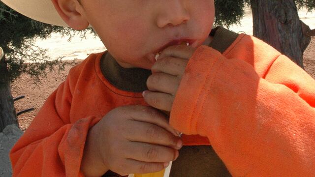 Virus Coxsackie Puebla: Grupo de primaria fue aislado por 4 casos