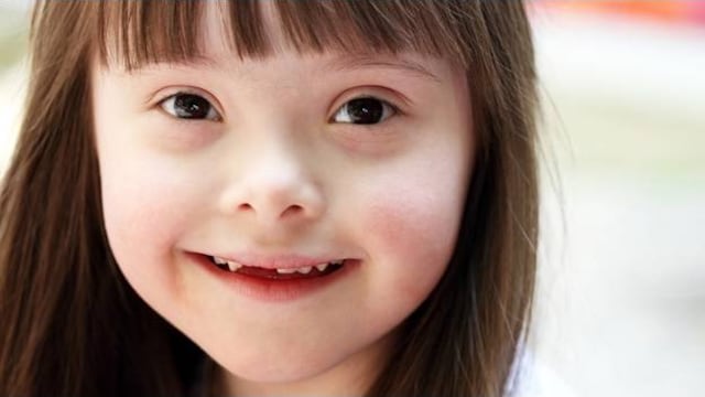 Una madre española promueve una petición a la RAE para que se deje de vincular al Síndrome de Down con el 'mongolismo' o lo 'subnormal' porque se emplean como insultos