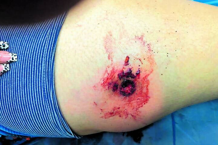 La ex novia de la actual pareja de Linda Amairanny es la principal sospechosa