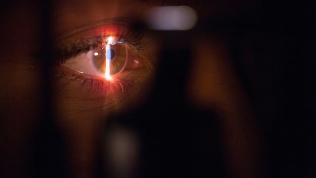 ¿Qué es la queratopigmentación? La cirugía que promete cambiar color de ojos