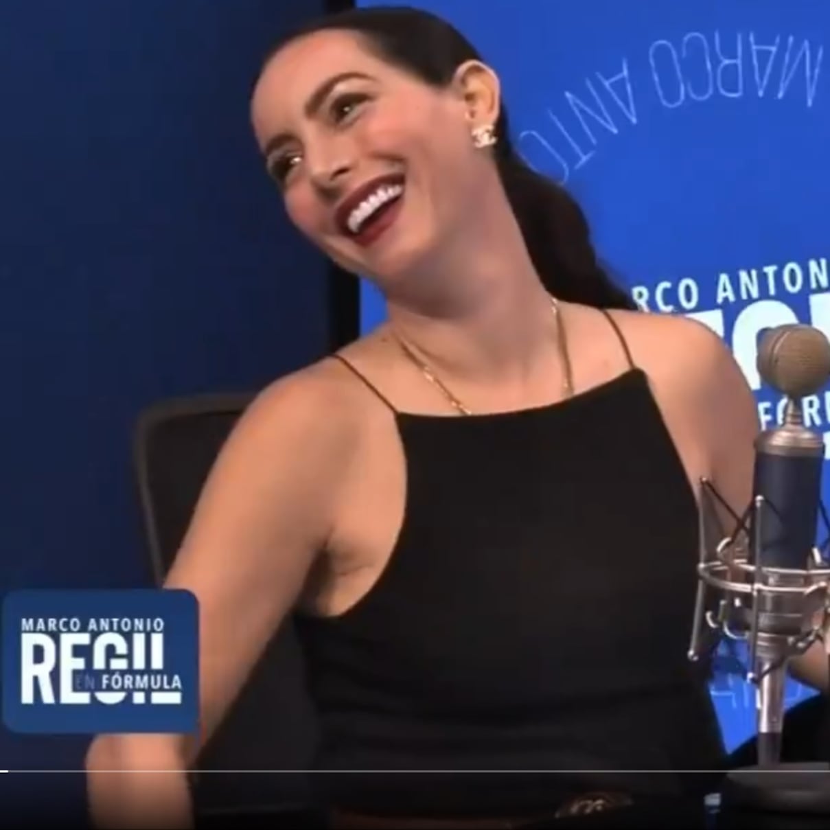 Claudia Lizaldi reacciona al bótox y la frase “ya dio el viejazo”