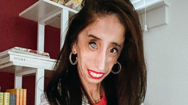 Lizzie Velasquez
