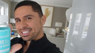 Así luce el rostro de Larry Hernández sin implantes dentales