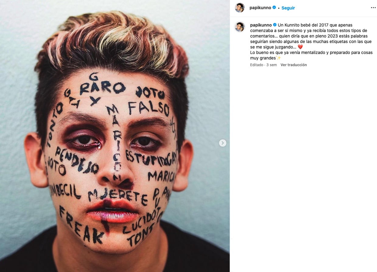 Kunno recibe hate desde el 2017, pero él sigue luchando contra las etiquetas.