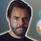 Eugenio Derbez estuvo a punto de perder el brazo tras accidente que le destrozó el hombro