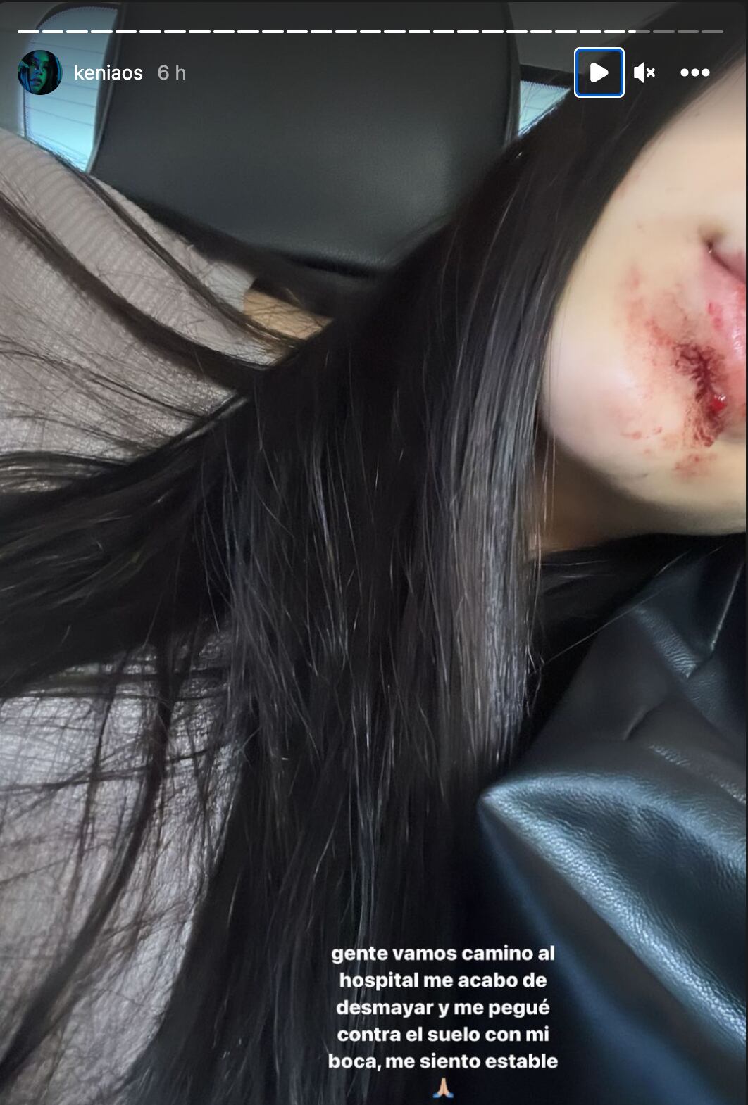 Kenia Os se desmayó y la caída le provocó una lesión en la boca