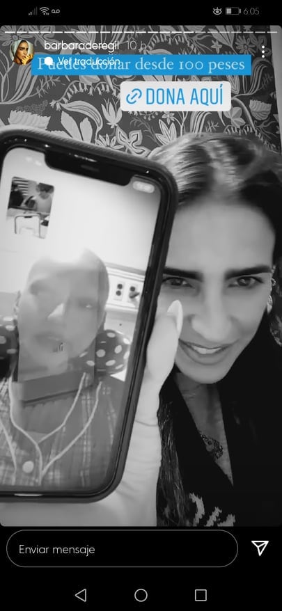 Bárbara de Regil pide ayuda para prótesis de niña.