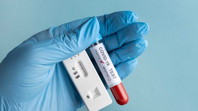 Prueba Covid-19 positiva.