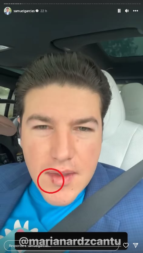 Samuel García aparece con una aparente mordida de Mariana Rodríguez.