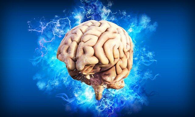 Cerebro