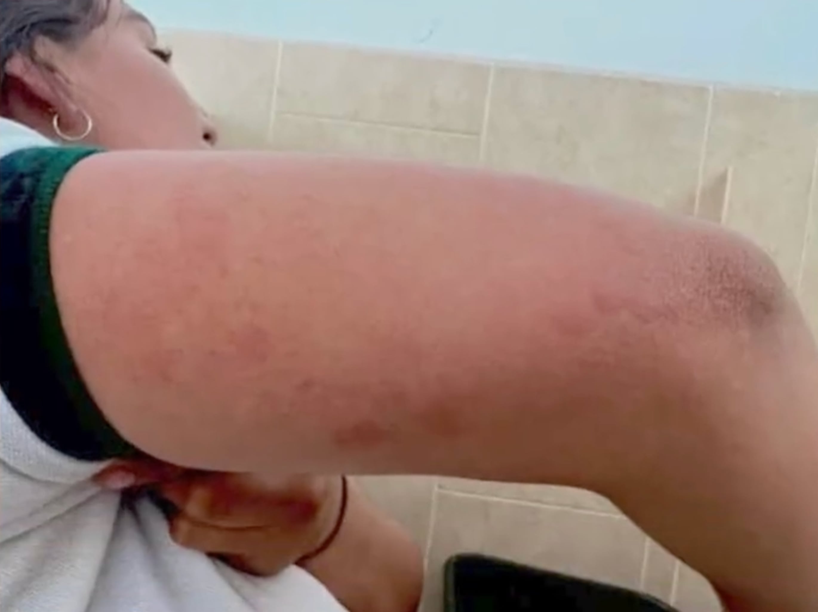 Conalep León I de Guanajuato reporta plaga de chinches