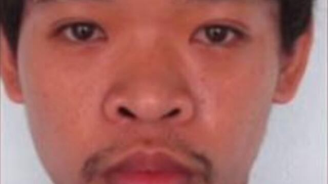 Antes de la cirugía estética