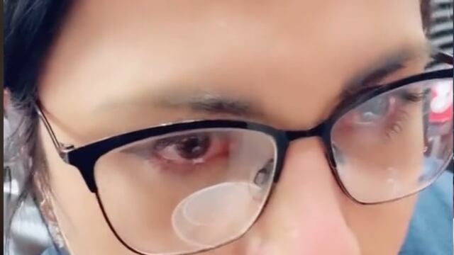 Mujer puertorriqueña casi se ahoga tras probar un chile 'toreado'