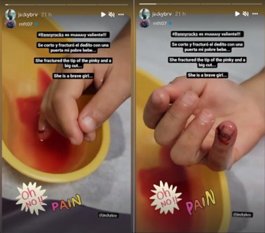 Hija de Jacqueline Bracamontes sufre accidente