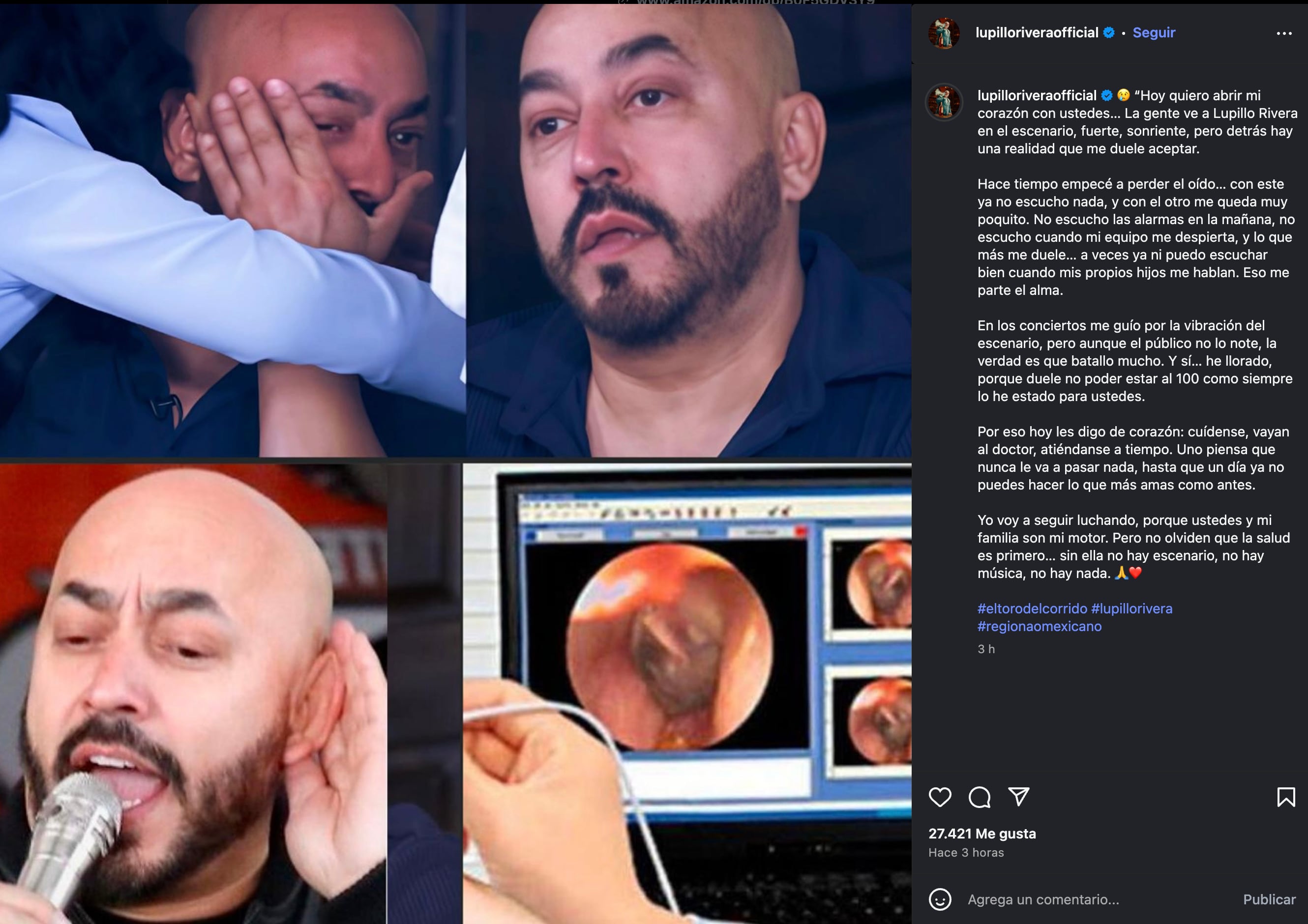 Lupillo Rivera confirma que perdió la audición de ambos oídos