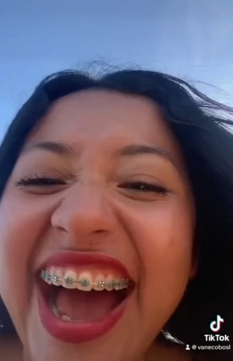 Mapache casi le roba el celular