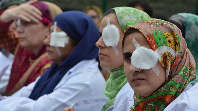 Médicos y paramédicos en un hospital de Srinagar en Cachemira, cubrieron uno de sus ojos para emular la difícil situación de las víctimas de las pistolas de perdigones, que se han quedado ciegos tras recibir disparos durante las protestas en curso en el estado del Himalaya.