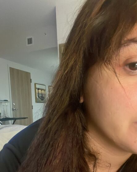 Quería ser rubia y terminó sin cabello