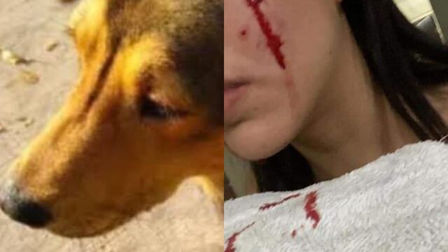 Adriana compartió fotos de las heridas provocadas por Rodolfo Corazón