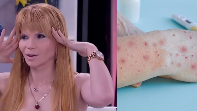 Mhoni Vidente y la viruela del mono