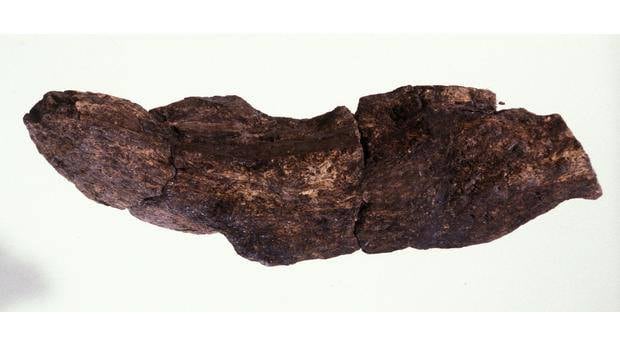 Popó humana más grande de la historia.