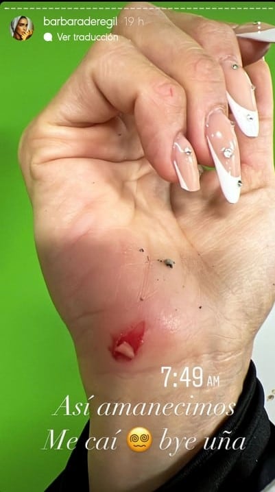 Bárbara de Regil se accidenta.