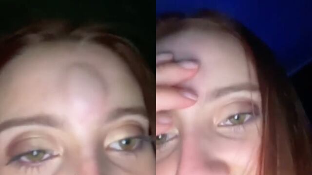 Peda termina mal hasta con chichón incluido