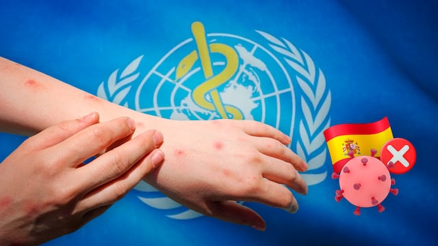 OMS quita estatus a España de país libre de sarampión