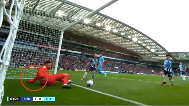 Lloris sufrió una brutal lesión en el codo