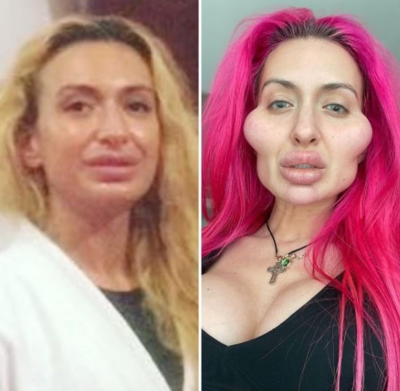 Transformación de Anastasia Pokreshchuk