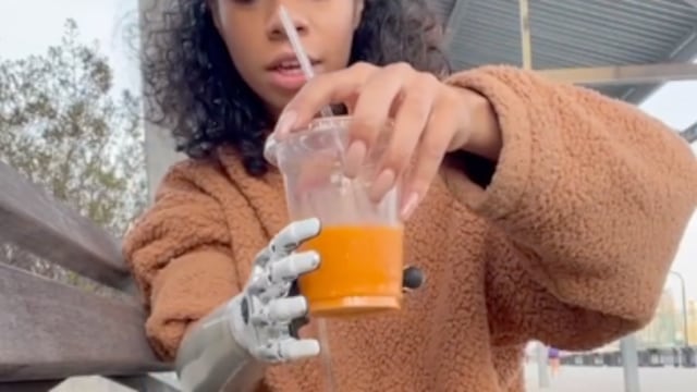 'Tiktoker' muestra su brazo biónico