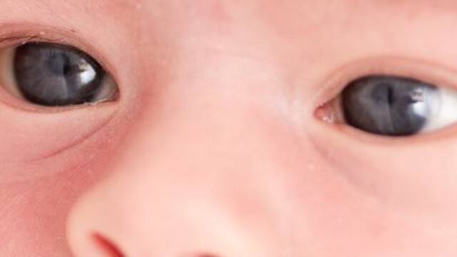 ¿Por qué le cambia el color de los ojos a los bebés?